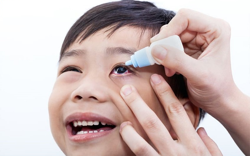 Cách chăm sóc trẻ em bị đau mắt đỏ đơn giản, an toàn tại nhà 