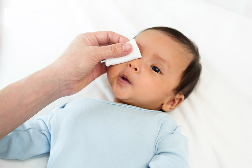 Cách chăm sóc trẻ em bị đau mắt đỏ đơn giản, an toàn tại nhà 